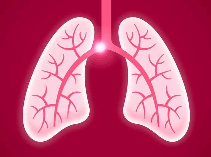 Human lungs showing pulmonary embolism concept.